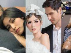 Musibah Menimpa Jessica Iskandar Sebelum Menikah, Ayahnya Ditabrak Mobil, Patah Tulang & Sulit Napas